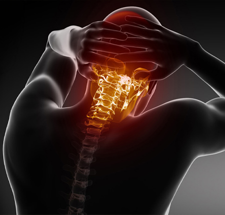 neck x-ray