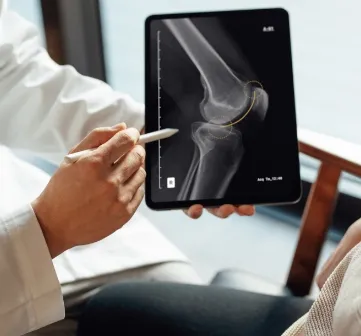 Digital X-Ray